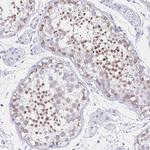 FAM170A Antibody in Immunohistochemistry (IHC)