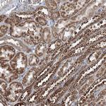 SKI3 Antibody in Immunohistochemistry (Paraffin) (IHC (P))