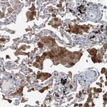 SKI3 Antibody in Immunohistochemistry (Paraffin) (IHC (P))