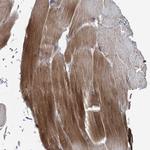 SKI3 Antibody in Immunohistochemistry (Paraffin) (IHC (P))