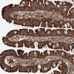 SKI3 Antibody in Immunohistochemistry (Paraffin) (IHC (P))