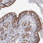 IFT46 Polyclonal Antibody