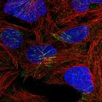 TRUB1 Polyclonal Antibody