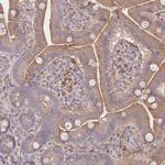 TRUB1 Antibody in Immunohistochemistry (Paraffin) (IHC (P))