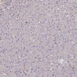 TRUB1 Antibody in Immunohistochemistry (Paraffin) (IHC (P))