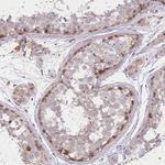 TRUB1 Antibody in Immunohistochemistry (Paraffin) (IHC (P))