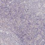 AAMDC Antibody in Immunohistochemistry (Paraffin) (IHC (P))