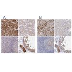 AAMDC Antibody in Immunohistochemistry (IHC)