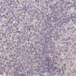 AAMDC Antibody in Immunohistochemistry (IHC)
