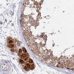 AAMDC Antibody in Immunohistochemistry (IHC)