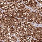 AAMDC Antibody in Immunohistochemistry (IHC)