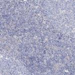 AAMDC Antibody in Immunohistochemistry (Paraffin) (IHC (P))