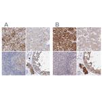 AAMDC Antibody in Immunohistochemistry (IHC)