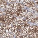 AAMDC Antibody in Immunohistochemistry (IHC)