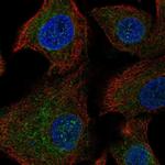 ANKRD16 Polyclonal Antibody