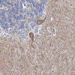 ANKRD16 Antibody in Immunohistochemistry (Paraffin) (IHC (P))