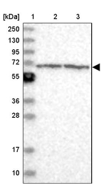 ENO4 Antibody in Western Blot (WB)