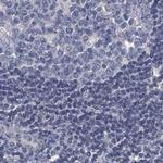 RTKN2 Antibody in Immunohistochemistry (IHC)