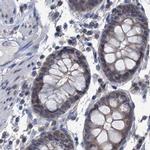 RTKN2 Antibody in Immunohistochemistry (IHC)