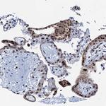 OLAH Polyclonal Antibody