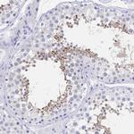 C10orf53 Antibody in Immunohistochemistry (IHC)