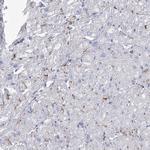 NRAP Antibody in Immunohistochemistry (Paraffin) (IHC (P))