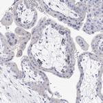 NRAP Antibody in Immunohistochemistry (Paraffin) (IHC (P))
