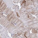 NRAP Antibody in Immunohistochemistry (Paraffin) (IHC (P))