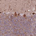PHLDB1 Polyclonal Antibody