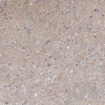LPHN1 Antibody in Immunohistochemistry (Paraffin) (IHC (P))