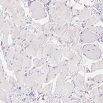 TMEM174 Antibody in Immunohistochemistry (Paraffin) (IHC (P))