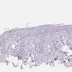 TMEM174 Antibody in Immunohistochemistry (Paraffin) (IHC (P))