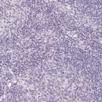 TMEM174 Antibody in Immunohistochemistry (IHC)