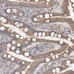 RUFY4 Antibody in Immunohistochemistry (Paraffin) (IHC (P))