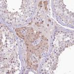 SLC6A11 Antibody in Immunohistochemistry (Paraffin) (IHC (P))