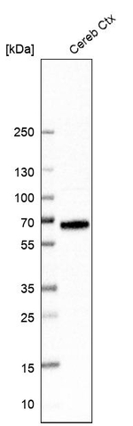 SLC6A11 Antibody in Western Blot (WB)