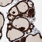 RAPGEF6 Antibody in Immunohistochemistry (Paraffin) (IHC (P))