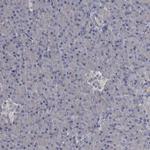 FLVCR2 Polyclonal Antibody