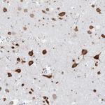BRUNOL4 Antibody in Immunohistochemistry (Paraffin) (IHC (P))