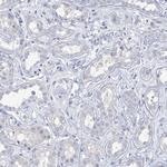 BRUNOL4 Antibody in Immunohistochemistry (Paraffin) (IHC (P))