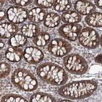 RNF150 Polyclonal Antibody