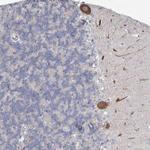 MEPE Antibody in Immunohistochemistry (Paraffin) (IHC (P))