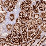 PSAPL1 Antibody in Immunohistochemistry (Paraffin) (IHC (P))