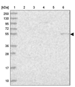 PSAPL1 Antibody in Western Blot (WB)