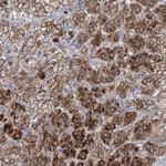 NME7 Antibody in Immunohistochemistry (Paraffin) (IHC (P))