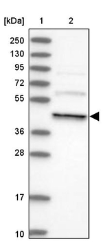 Dynactin 4 Antibody in Western Blot (WB)