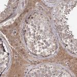 KIAA0825 Polyclonal Antibody