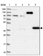 PDSS1 Antibody in Western Blot (WB)