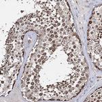 TTC40 Polyclonal Antibody