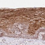 ASCC1 Polyclonal Antibody